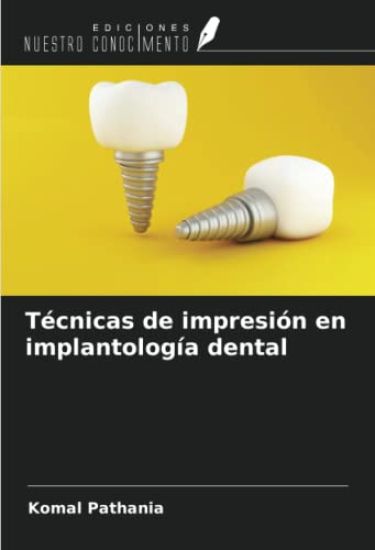 Técnicas de impresión en implantología dental