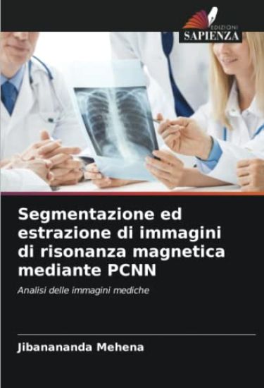 Segmentazione ed estrazione di immagini di risonanza magnetica mediante PCNN