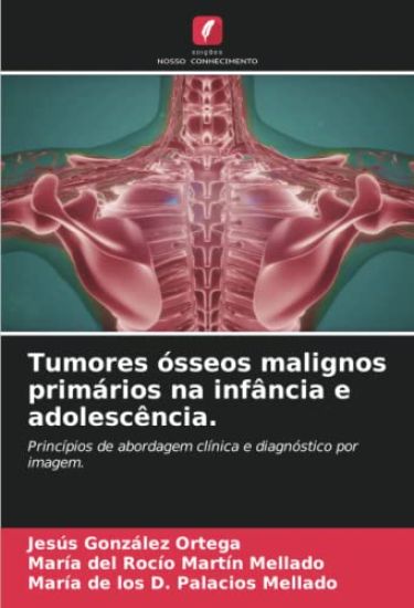 Tumores ósseos malignos primários na infância e adolescência.
