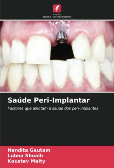 Saúde Peri-Implantar