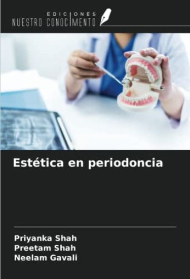 Estética en periodoncia