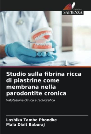 Studio sulla fibrina ricca di piastrine come membrana nella parodontite cronica