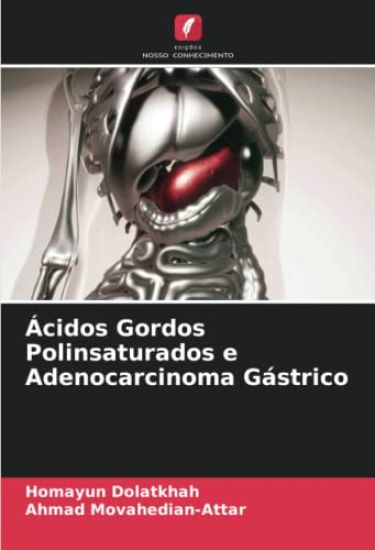 Ácidos Gordos Polinsaturados e Adenocarcinoma Gástrico