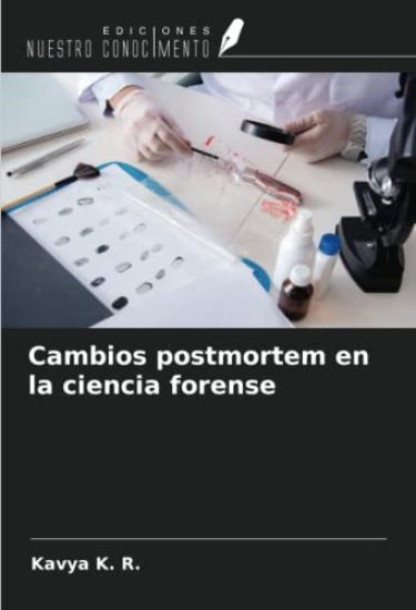 Cambios postmortem en la ciencia forense