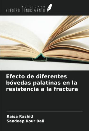 Efecto de diferentes bóvedas palatinas en la resistencia a la fractura