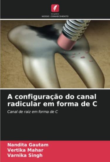 A configuração do canal radicular em forma de C