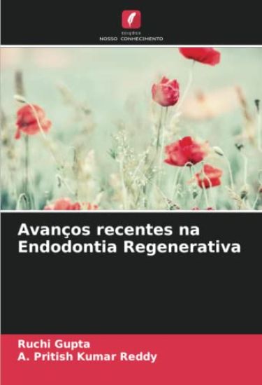 Avanços recentes na Endodontia Regenerativa