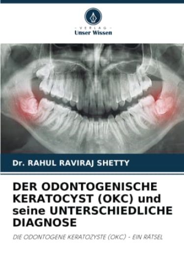 DER ODONTOGENISCHE KERATOCYST (OKC) und seine UNTERSCHIEDLICHE DIAGNOSE