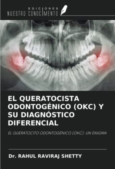 EL QUERATOCISTA ODONTOGÉNICO (OKC) Y SU DIAGNÓSTICO DIFERENCIAL