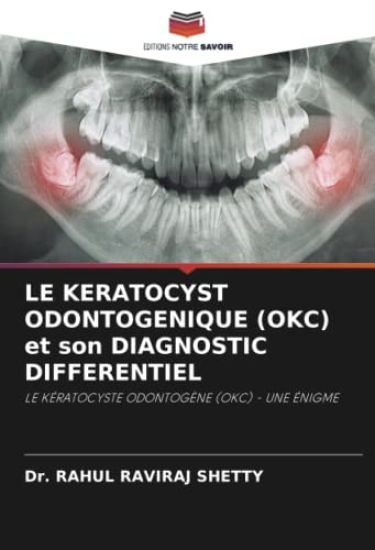 LE KERATOCYST ODONTOGENIQUE (OKC) et son DIAGNOSTIC DIFFERENTIEL