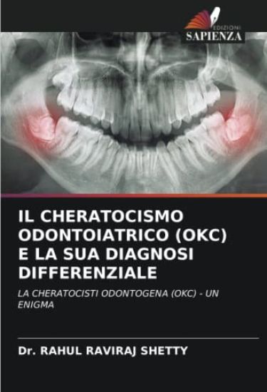 IL CHERATOCISMO ODONTOIATRICO (OKC) E LA SUA DIAGNOSI DIFFERENZIALE