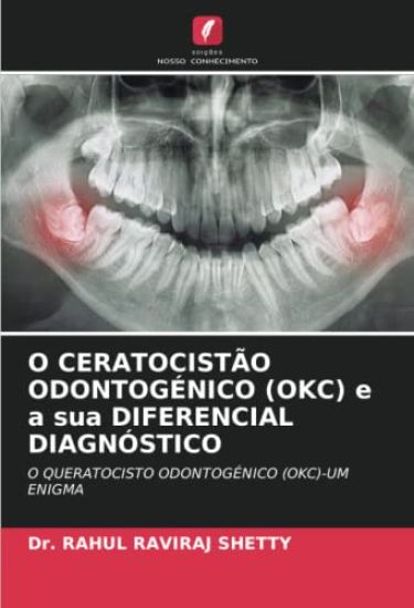 O CERATOCISTÃO ODONTOGÉNICO (OKC) e a sua DIFERENCIAL DIAGNÓSTICO