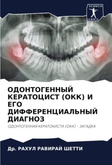 ODONTOGENNYJ KERATOCIST (OKK) I EGO DIFFERENCIAL'NYJ DIAGNOZ