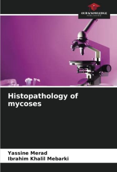 Histopathology of mycoses