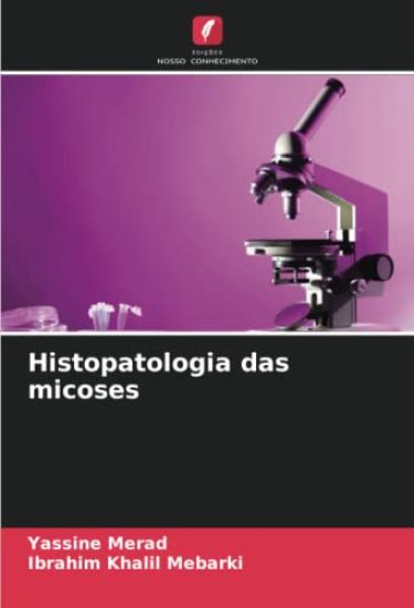 Histopatologia das micoses