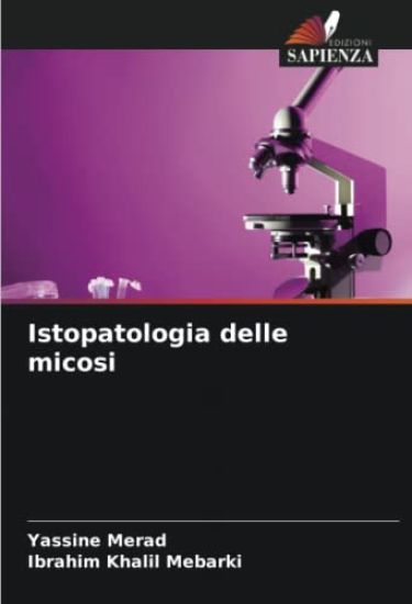 Istopatologia delle micosi