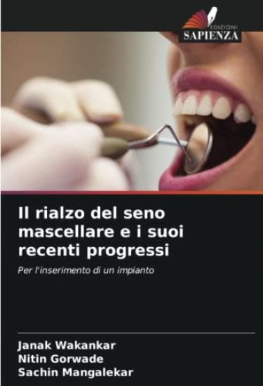 Il rialzo del seno mascellare e i suoi recenti progressi