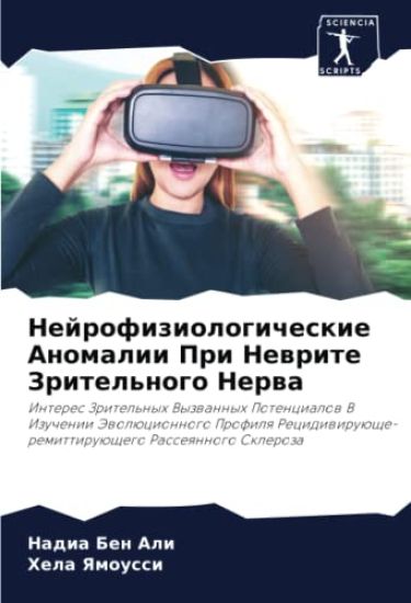 Nejrofiziologicheskie Anomalii Pri Newrite Zritel'nogo Nerwa