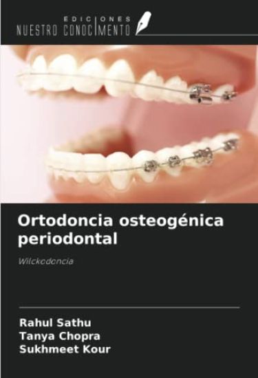 Ortodoncia osteogénica periodontal