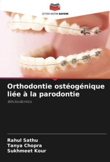 Orthodontie ostéogénique liée à la parodontie