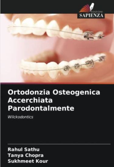 Ortodonzia Osteogenica Accerchiata Parodontalmente
