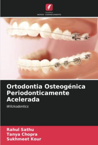 Ortodontia Osteogénica Periodonticamente Acelerada