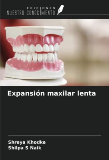 Expansión maxilar lenta
