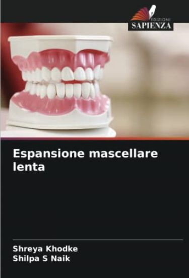 Espansione mascellare lenta