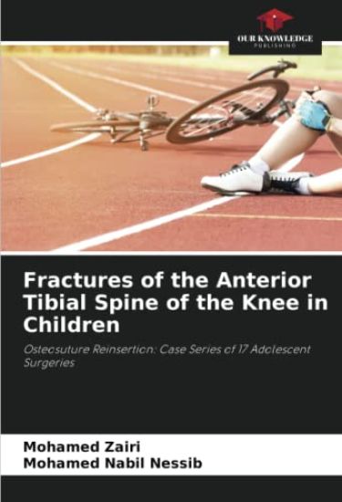 Fractures of the Anterior Tibial Spine of the Knee in Children
