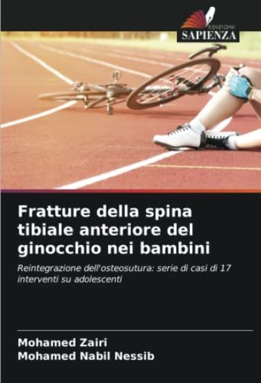 Fratture della spina tibiale anteriore del ginocchio nei bambini