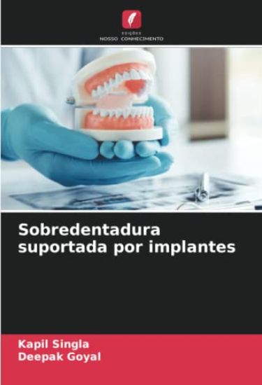 Sobredentadura suportada por implantes