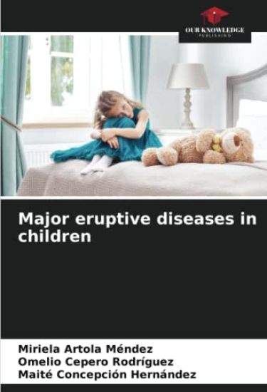 Major eruptive diseases in children