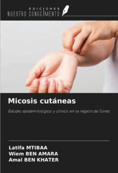 Micosis cutáneas
