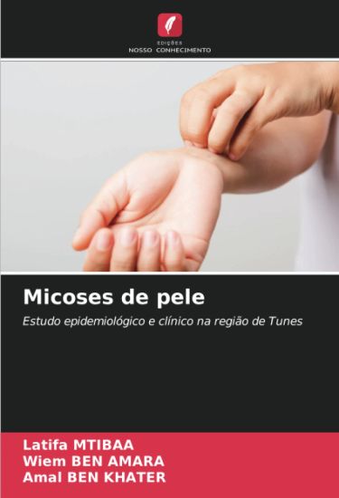 Micoses de pele