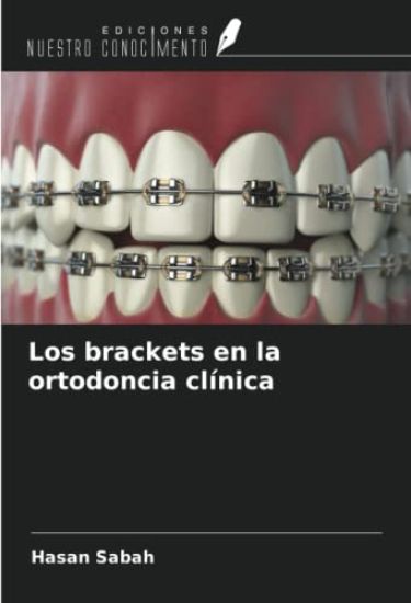 Los brackets en la ortodoncia clínica