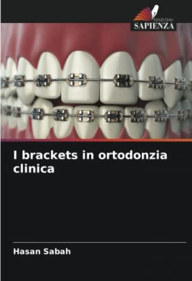 I brackets in ortodonzia clinica
