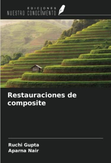 Restauraciones de composite