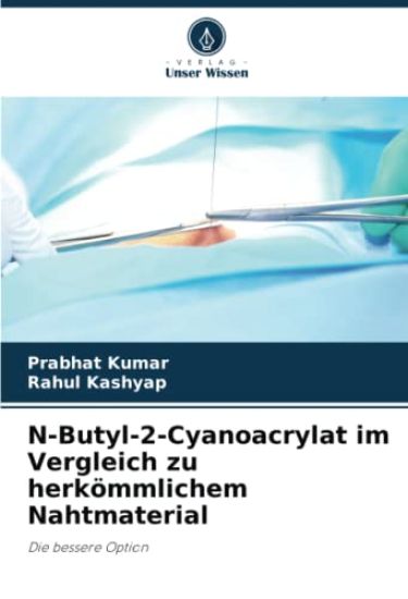 N-Butyl-2-Cyanoacrylat im Vergleich zu herkömmlichem Nahtmaterial