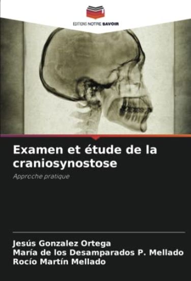 Examen et étude de la craniosynostose