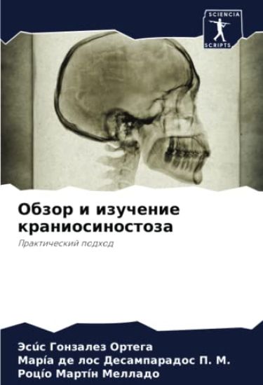 Obzor i izuchenie kraniosinostoza
