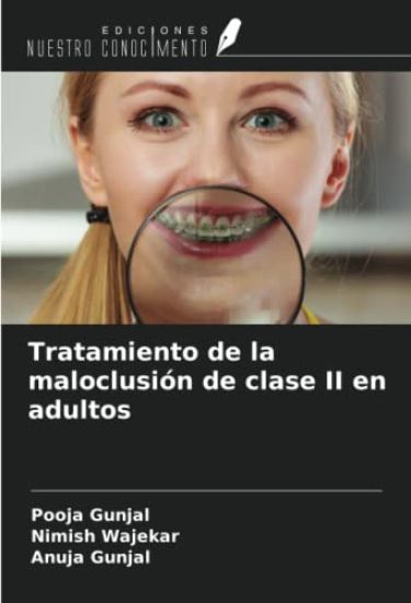 Tratamiento de la maloclusión de clase II en adultos