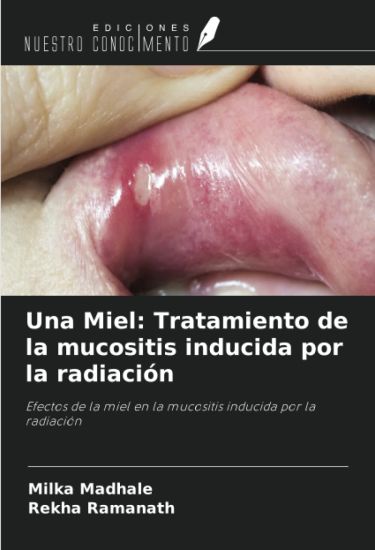 Una Miel: Tratamiento de la mucositis inducida por la radiación