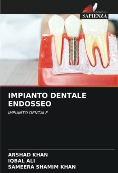 IMPIANTO DENTALE ENDOSSEO
