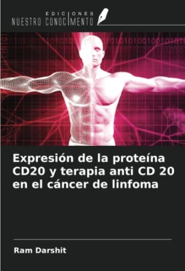 Expresión de la proteína CD20 y terapia anti CD 20 en el cáncer de linfoma