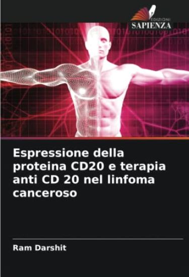 Espressione della proteina CD20 e terapia anti CD 20 nel linfoma canceroso