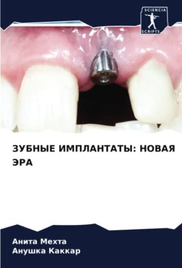 ZUBNYE IMPLANTATY: NOVAYa JeRA