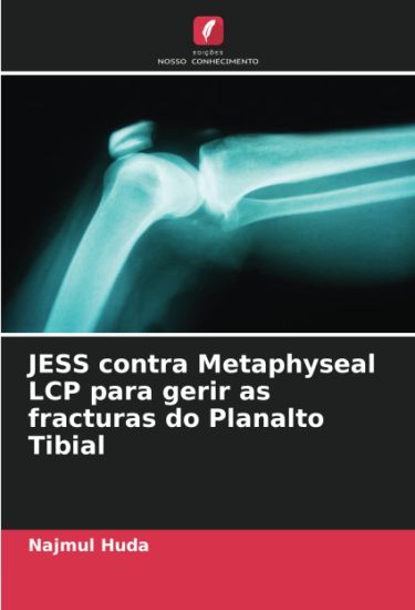 JESS contra Metaphyseal LCP para gerir as fracturas do Planalto Tibial
