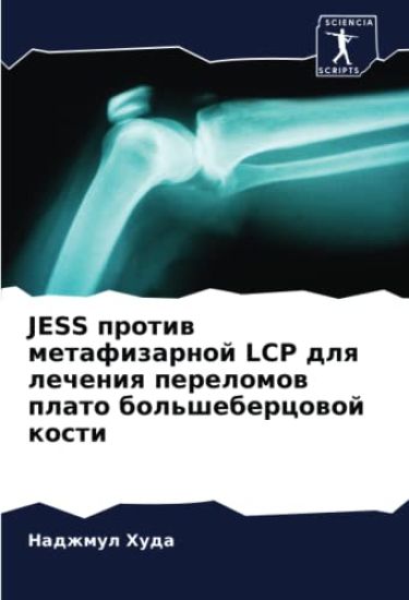 JESS protiw metafizarnoj LCP dlq lecheniq perelomow plato bol'shebercowoj kosti