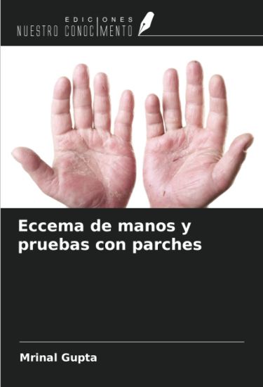 Eccema de manos y pruebas con parches