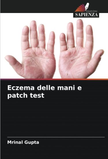 Eczema delle mani e patch test